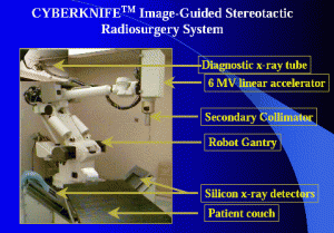 CyberKnife Radiosurgery System