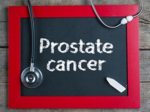 Prostate cancer and radiotherapy