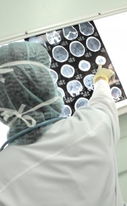 brain tumor triple therapy radiotherapy