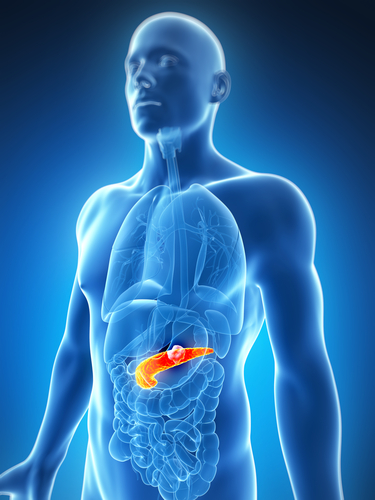 radiotherapy and pancreatic cancer